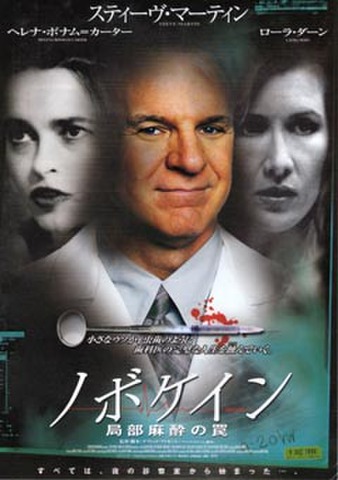 映画チラシ： ノボケイン　局部麻酔の罠